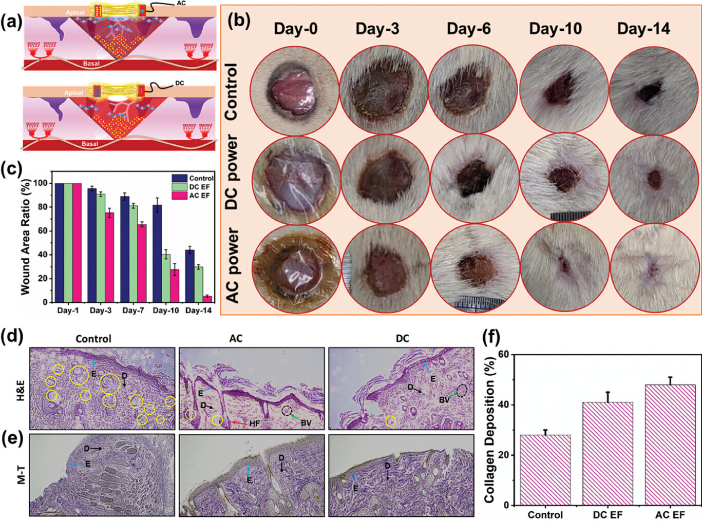 Figure 6 a) Schematic demonstration of AC and DC ES process on wounded area. b) Photograph of wounded skin at various time intervals. c) Wound area recovery after 3, 7, 10, 14 d of treatment. d) H&E and e) M–T histogram examination of newly formed skin tissue. f) Collagen density measurement of M–T image.